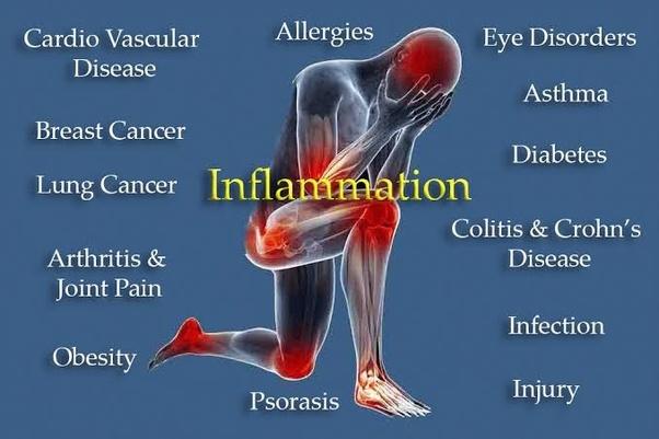 OMEGA-3´S MAY HELP REDUCE THE INTENSITY OF AN INFLAMMATORY RESPONSE - Vital Remedy MD 